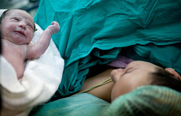 Caesarean section birth with mother and baby