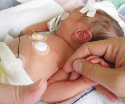 Premature newborn baby