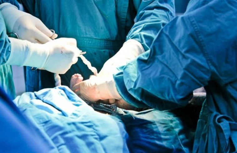 Doctors performing a c-section