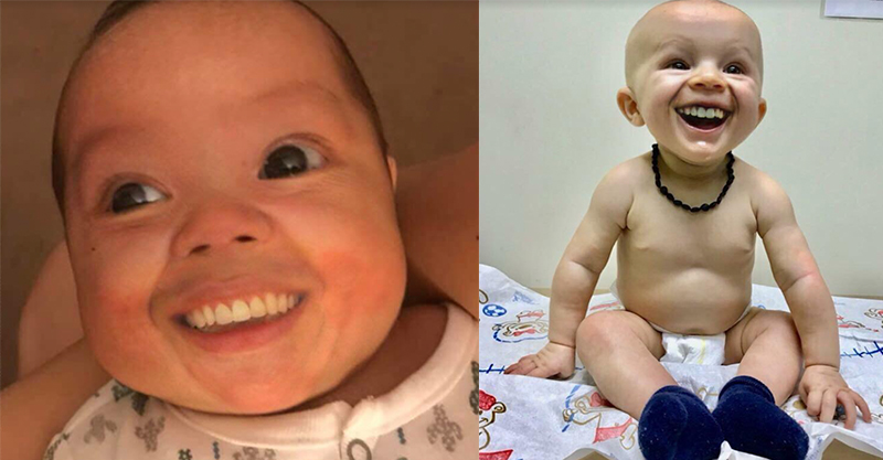 A new meme puts teeth on babies and the results are hilarious