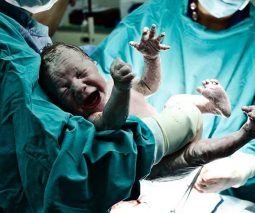 Incredible photo of baby after birth