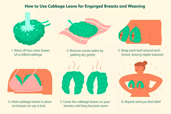 Cabbage leaves and breast engorgement 