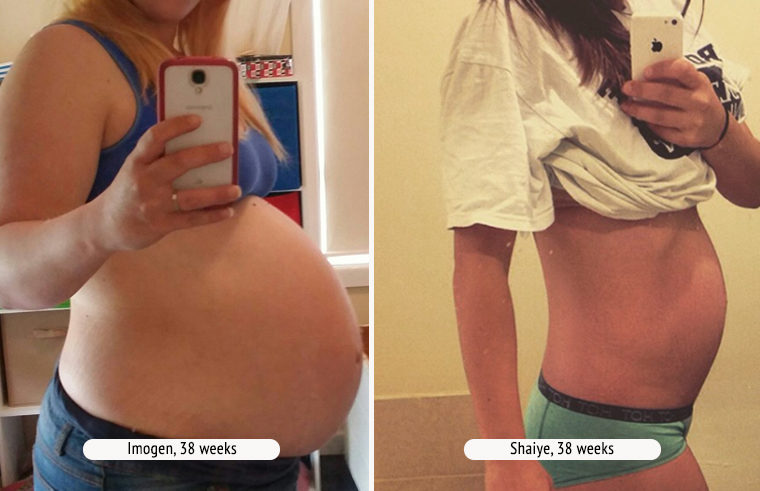 Comparison photo of two pregnant women at 38 weeks