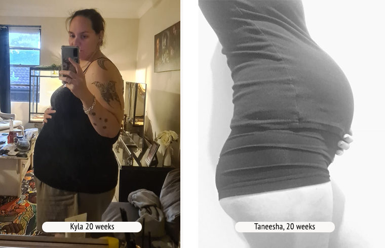 Comparison photo of two pregnant women at 20 weeks