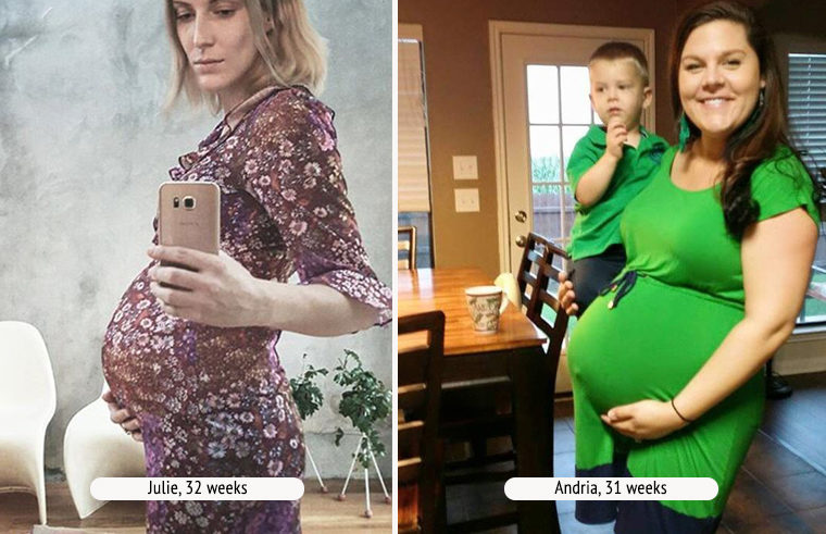 Comparison photo of two pregnant women at 32 weeks